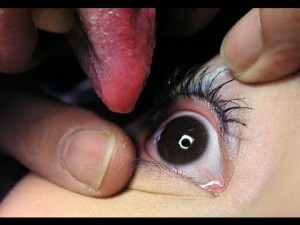 eyeball-licking