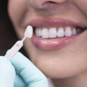 Dentist using a palette tooth color sample.