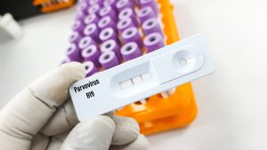 Scientist holding rapid screening test cassette for Parvovirus B19 test at medical laboratory. To diagnosis parvovirus RNA, selective focus